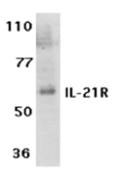 Western blot - IL-21 Receptor Antibody from Signalway Antibody (24144) - Antibodies.com