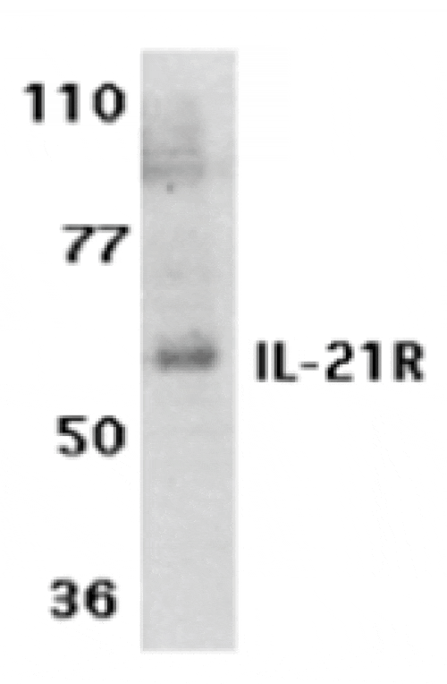 Western blot - IL-21 Receptor Antibody from Signalway Antibody (24144) - Antibodies.com