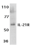 Western blot - IL-21 Receptor Antibody from Signalway Antibody (24144) - Antibodies.com