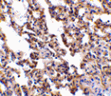 Immunohistochemistry - IL-21 Receptor Antibody from Signalway Antibody (24144) - Antibodies.com
