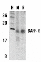 Western blot - BAFF Receptor Antibody from Signalway Antibody (24185) - Antibodies.com