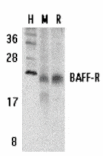 Western blot - BAFF Receptor Antibody from Signalway Antibody (24185) - Antibodies.com