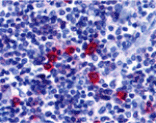 Immunohistochemistry - BAFF Receptor Antibody from Signalway Antibody (24185) - Antibodies.com