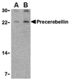 Western blot - Precerebellin Antibody from Signalway Antibody (24340) - Antibodies.com