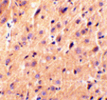 Immunohistochemistry - Precerebellin Antibody from Signalway Antibody (24340) - Antibodies.com