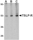 Western blot - TSLP Receptor Antibody from Signalway Antibody (24528) - Antibodies.com