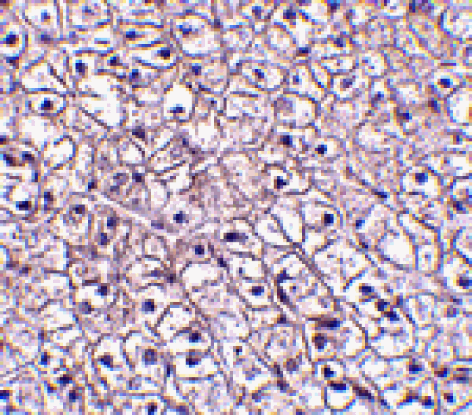 Immunohistochemistry - TSLP Receptor Antibody from Signalway Antibody (24528) - Antibodies.com