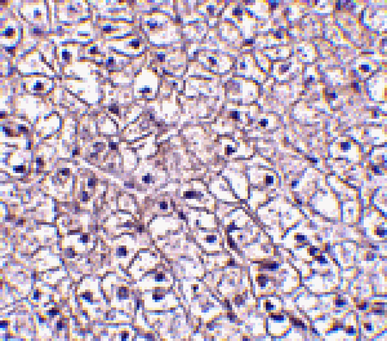 Immunohistochemistry - TSLP Receptor Antibody from Signalway Antibody (24528) - Antibodies.com