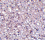 Immunohistochemistry - TSLP Receptor Antibody from Signalway Antibody (24528) - Antibodies.com