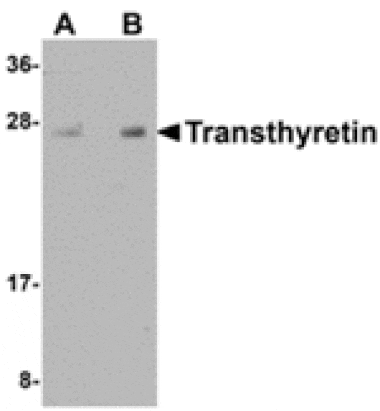 Western blot - Transthyretin Antibody from Signalway Antibody (24890) - Antibodies.com