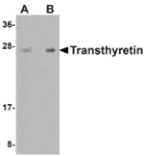 Western blot - Transthyretin Antibody from Signalway Antibody (24890) - Antibodies.com