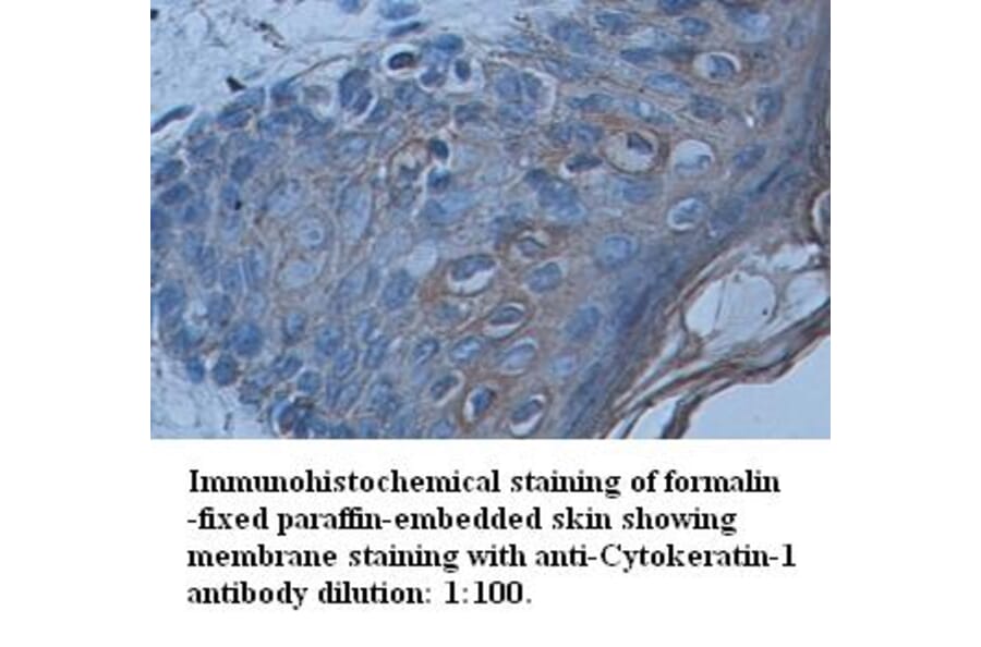 Cytokeratin-1 Antibody from Signalway Antibody (39339) - Antibodies.com