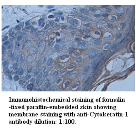 Cytokeratin-1 Antibody from Signalway Antibody (39339) - Antibodies.com