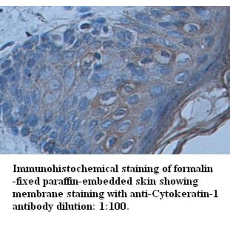 Cytokeratin-1 Antibody from Signalway Antibody (39339) - Antibodies.com