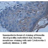 Cytokeratin-1 Antibody from Signalway Antibody (39339) - Antibodies.com