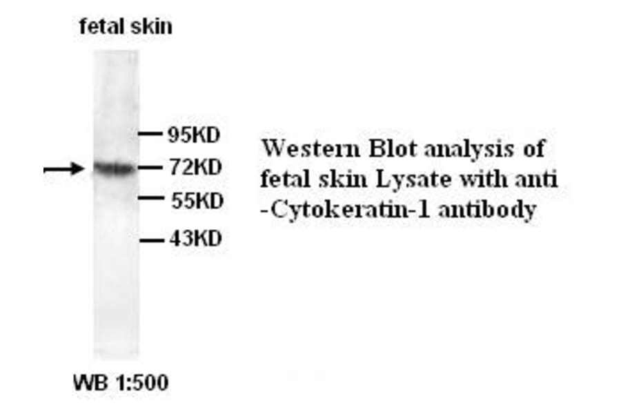Cytokeratin-1 Antibody from Signalway Antibody (39339) - Antibodies.com