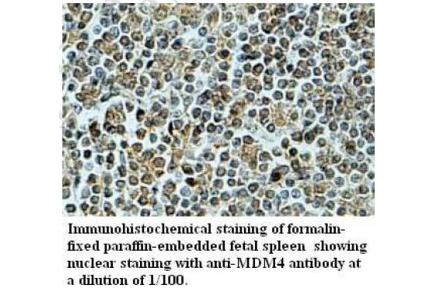 MDM4 Antibofy Antibody from Signalway Antibody (39704) - Antibodies.com