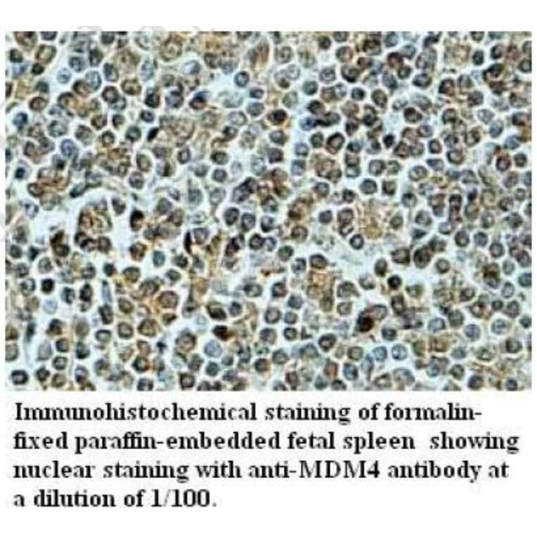 MDM4 Antibofy Antibody from Signalway Antibody (39704) - Antibodies.com