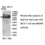 MDM4 Antibofy Antibody from Signalway Antibody (39704) - Antibodies.com