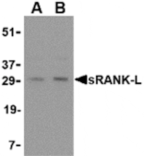 Western blot - sRANK Ligand Antibody from Signalway Antibody (24464) - Antibodies.com