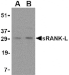 Western blot - sRANK Ligand Antibody from Signalway Antibody (24464) - Antibodies.com