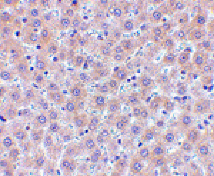 Immunohistochemistry - sRANK Ligand Antibody from Signalway Antibody (24464) - Antibodies.com