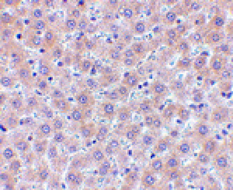 Immunohistochemistry - sRANK Ligand Antibody from Signalway Antibody (24464) - Antibodies.com