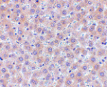 Immunohistochemistry - sRANK Ligand Antibody from Signalway Antibody (24464) - Antibodies.com