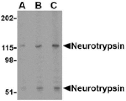 Western blot - Neurotrypsin Antibody from Signalway Antibody (24518) - Antibodies.com