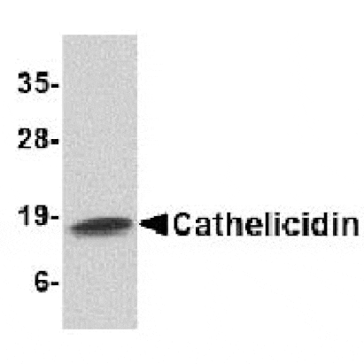 Western blot - Cathelicidin Antibody from Signalway Antibody (24621) - Antibodies.com