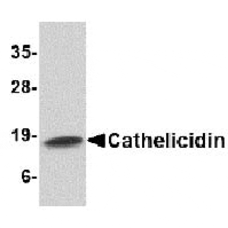 Western blot - Cathelicidin Antibody from Signalway Antibody (24621) - Antibodies.com