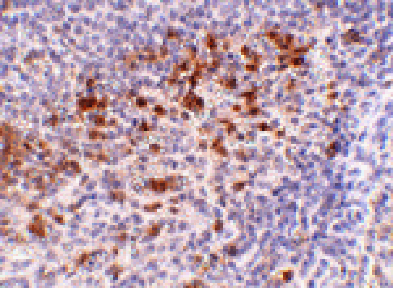 Immunohistochemistry - Cathelicidin Antibody from Signalway Antibody (24621) - Antibodies.com