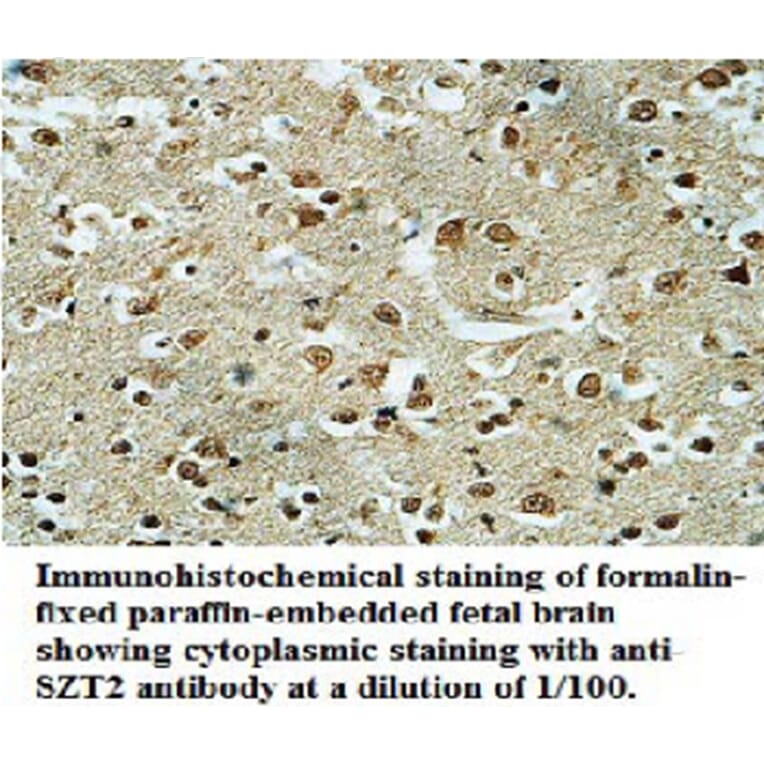 SZT2 Anibody Antibody from Signalway Antibody (39697) - Antibodies.com