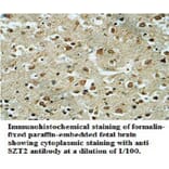 SZT2 Anibody Antibody from Signalway Antibody (39697) - Antibodies.com