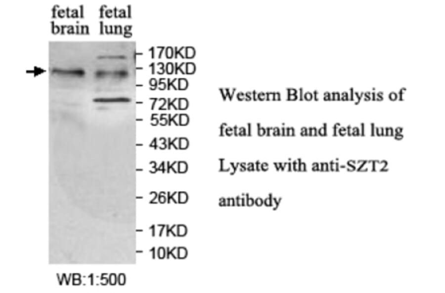 SZT2 Anibody Antibody from Signalway Antibody (39697) - Antibodies.com