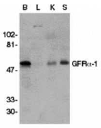 Western blot - GFR alpha 1 Antibody from Signalway Antibody (24019) - Antibodies.com