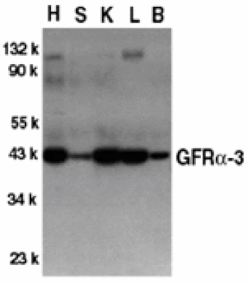 Western blot - GFR alpha 3 Antibody from Signalway Antibody (24021) - Antibodies.com