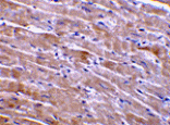 Immunohistochemistry - GFR alpha 3 Antibody from Signalway Antibody (24021) - Antibodies.com