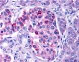 Immunohistochemistry - IKK epsilon Antibody from Signalway Antibody (24121) - Antibodies.com