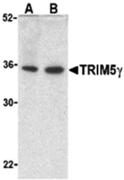 Western blot - TRIM5 gamma Antibody from Signalway Antibody (24222) - Antibodies.com