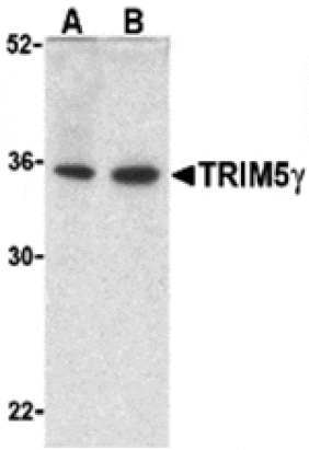 Western blot - TRIM5 gamma Antibody from Signalway Antibody (24222) - Antibodies.com