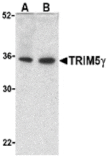 Western blot - TRIM5 gamma Antibody from Signalway Antibody (24222) - Antibodies.com