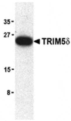 Western blot - TRIM5 delta Antibody from Signalway Antibody (24223) - Antibodies.com