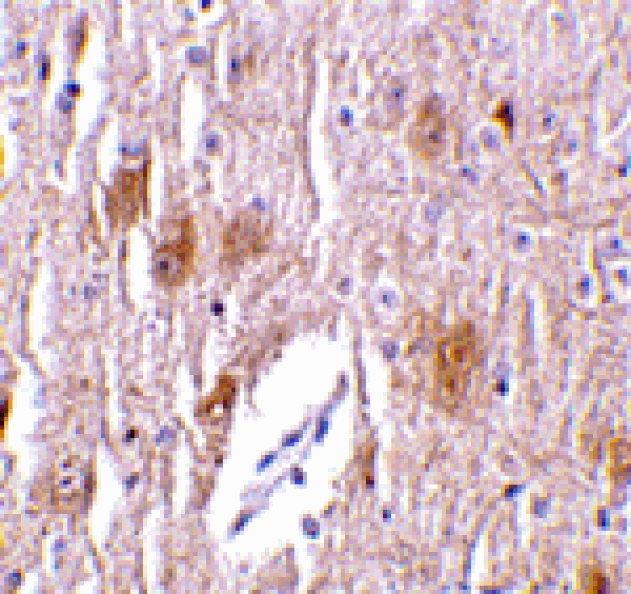 Immunohistochemistry - TRIM5 delta Antibody from Signalway Antibody (24223) - Antibodies.com
