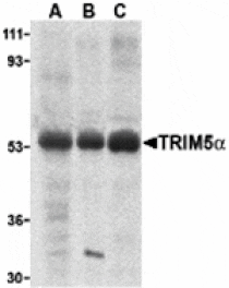 Western blot - TRIM5 alpha Antibody from Signalway Antibody (24224) - Antibodies.com