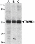 Western blot - TRIM5 alpha Antibody from Signalway Antibody (24224) - Antibodies.com