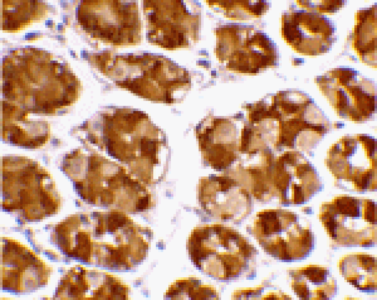 Immunohistochemistry - TRIM5 alpha Antibody from Signalway Antibody (24224) - Antibodies.com