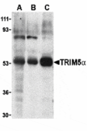 Western blot - TRIM5 alpha Antibody from Signalway Antibody (24226) - Antibodies.com