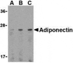 Western blot - Adiponectin Antibody from Signalway Antibody (24323) - Antibodies.com