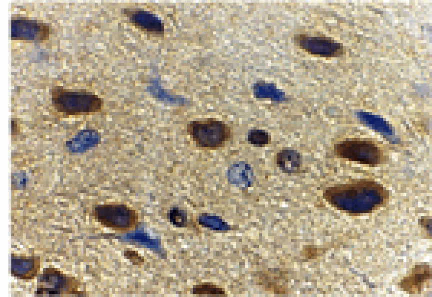 Immunohistochemistry - Adiponectin Antibody from Signalway Antibody (24323) - Antibodies.com